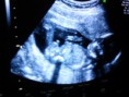 /album/mundo-ecografico/a2012-01-18-14-38-46-jpg/